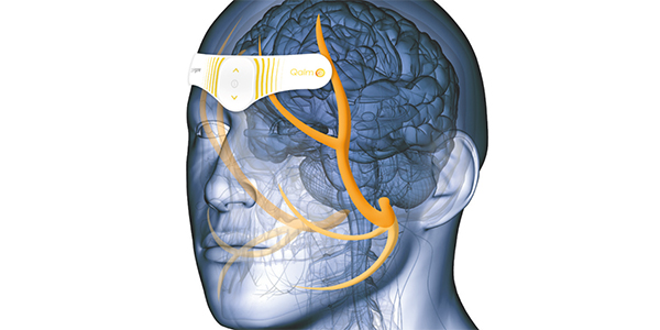 Le nerf trijumeau est responsable de la plupart des migraines.